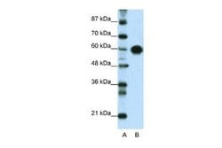 ZSCAN5 Rabbit anti-Human, Polyclonal, Novus Biologicals 100 &mu;g | Buy Online | Novus Biologicals | Fisher Scientific